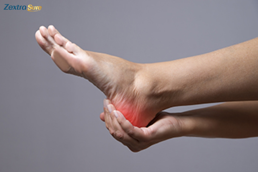 Some factors can affect high levels of uric acid